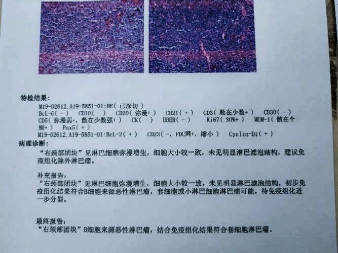 港彩二四六天天好资料和患瘤拒上夜班被开除与患瘤拒上夜班被开除有赔偿吗